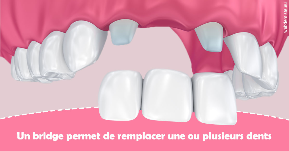 https://dr-le-petit-xavier.chirurgiens-dentistes.fr/Bridge remplacer dents 2