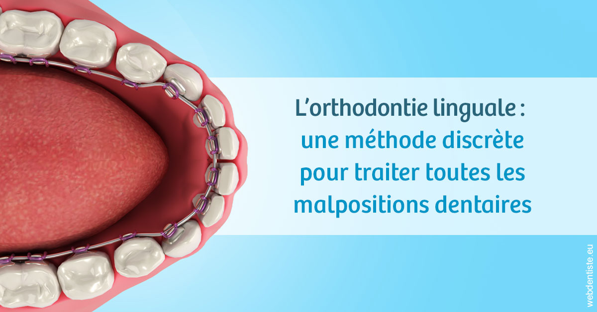 https://dr-le-petit-xavier.chirurgiens-dentistes.fr/L'orthodontie linguale 1