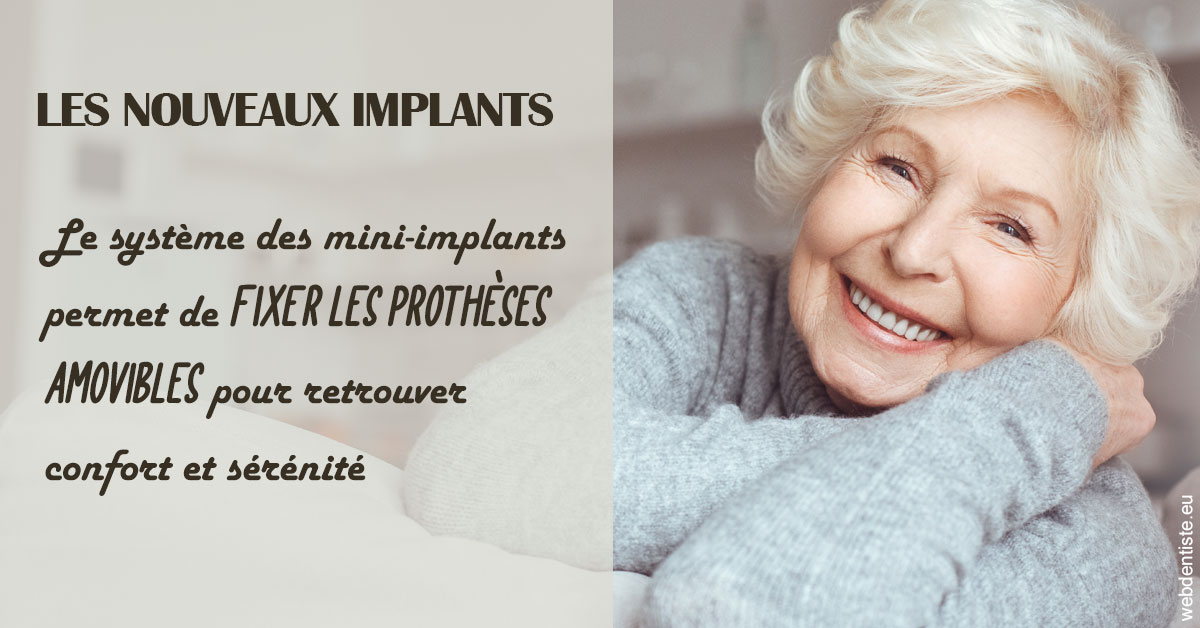 https://dr-le-petit-xavier.chirurgiens-dentistes.fr/Les nouveaux implants 1