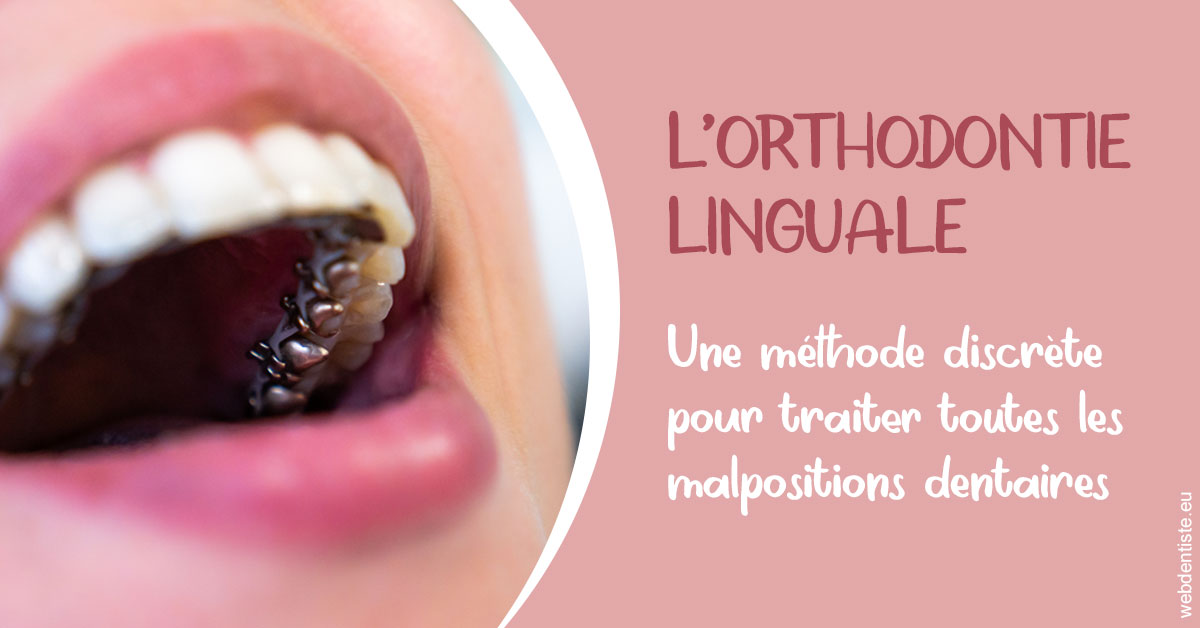 https://dr-le-petit-xavier.chirurgiens-dentistes.fr/L'orthodontie linguale 2