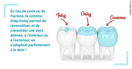 https://dr-le-petit-xavier.chirurgiens-dentistes.fr/L'INLAY ou l'ONLAY