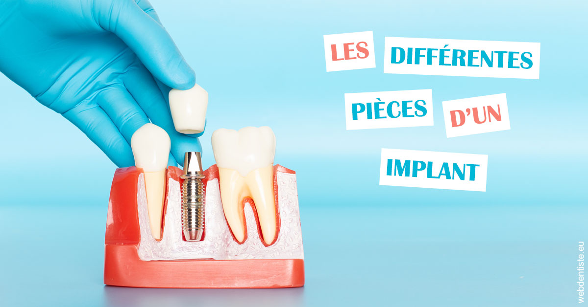 https://dr-le-petit-xavier.chirurgiens-dentistes.fr/Les différentes pièces d’un implant 2