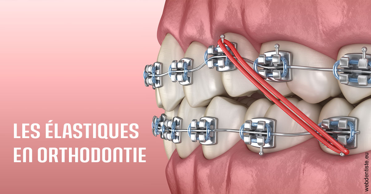 https://dr-le-petit-xavier.chirurgiens-dentistes.fr/Elastiques orthodontie 2