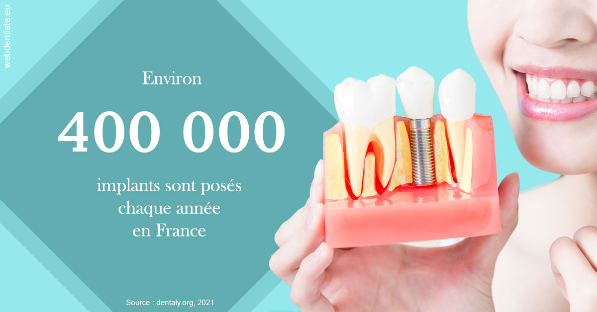 https://dr-le-petit-xavier.chirurgiens-dentistes.fr/Pose d'implants en France 2